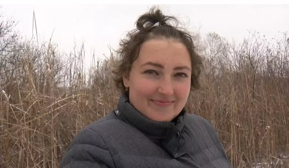 Individuals w/ Rare Disease that Causes Hair Loss May Have Hope Thanks to the U